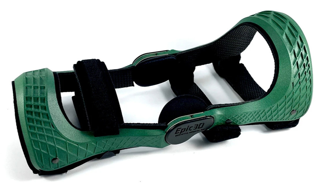 A 3D-printed bespoke BMI knee brace